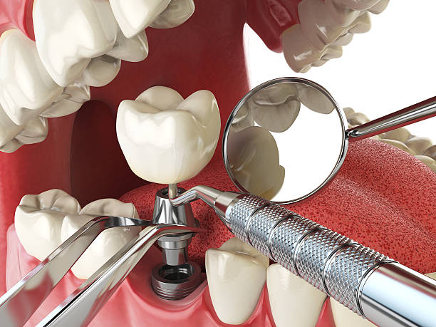 Best After-Hours Dental Trauma Care in Hutchinson, MN